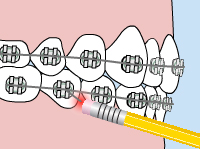 Poking wire